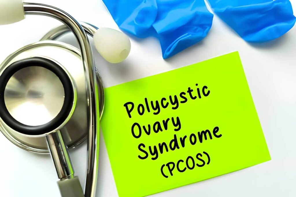 PCOS