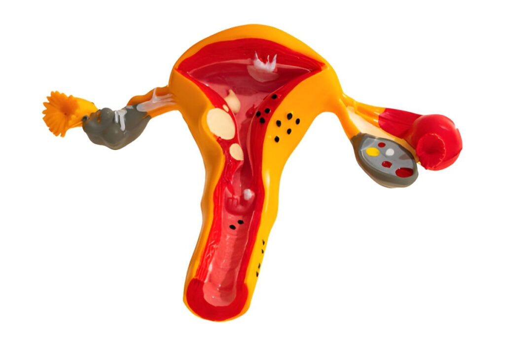 Does the Hymen Still Symbolize Virginity? Symbolize Virginity